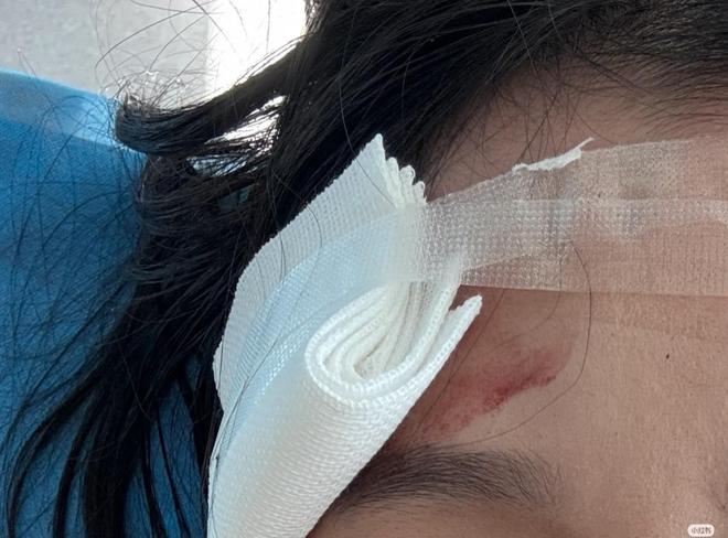 香港現金網：大连梅花鹿连撞两人，受伤女游客发声：我没招惹它，它突然冲过来！景区回应